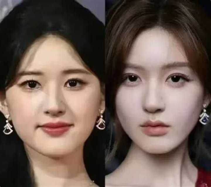 Zhou Chuna Plastic Surgery: Who is Zhou Chuna? What Happened To Her? - SarkariResult
